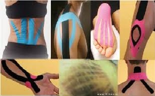 kineziology tape